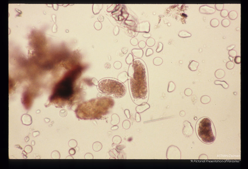 Eggs in stool. Iodine stained.