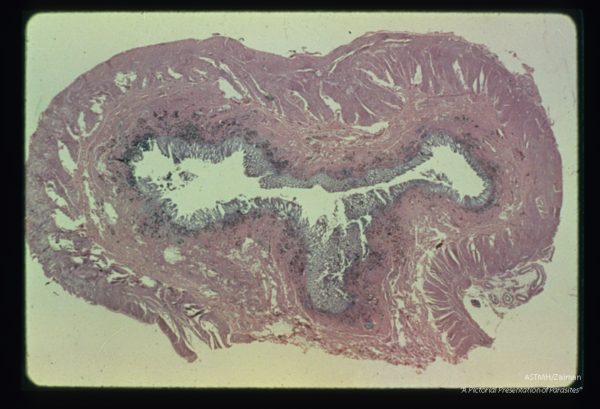 Cross section of bowel wall. This low power view of the bowel in cross section shows one pair of adults in each of two mesenteric veins plus eggs which present as dark spots in the mucosa and submucosa. Compare with slides No. 17 and 18.