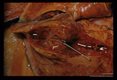 Cat lung showing an open cyst (pin point) from which the worm has left