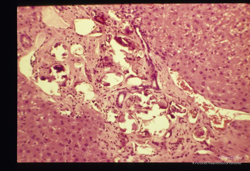 Eggs in armadillo (Dasypus novemcinctus) liver.