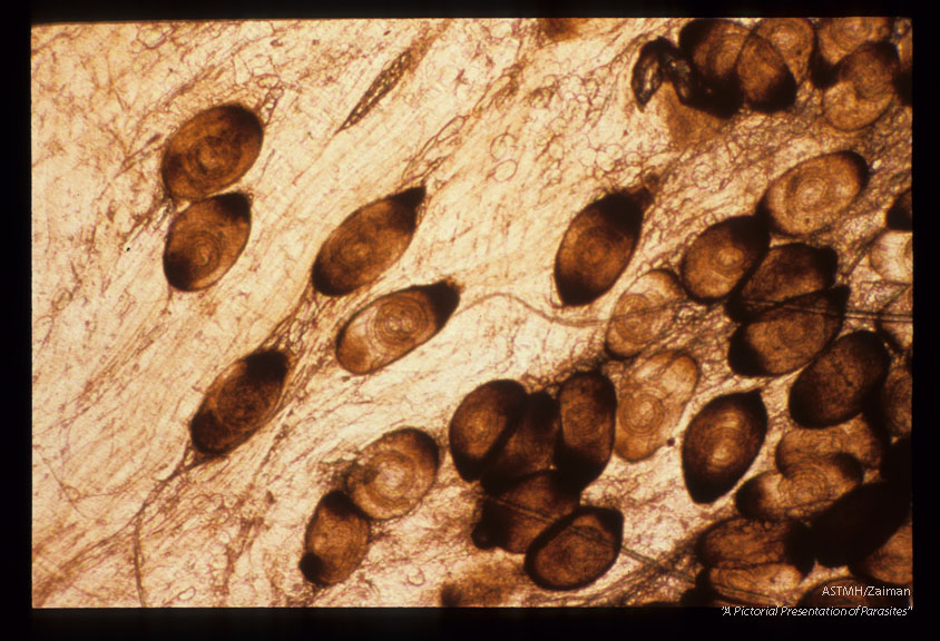 Various magnifications of calcified cysts in masseter muscle of rat xeroradiographed in slide 1602.