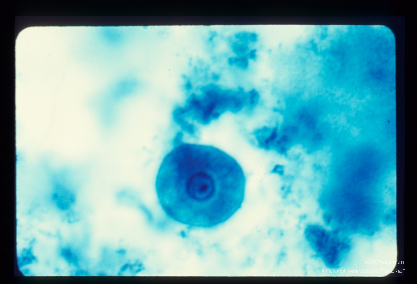 Trophozoite. Iron hematoxylin stain. A karyosome (endosome) within the nucleus is eccentric and large.