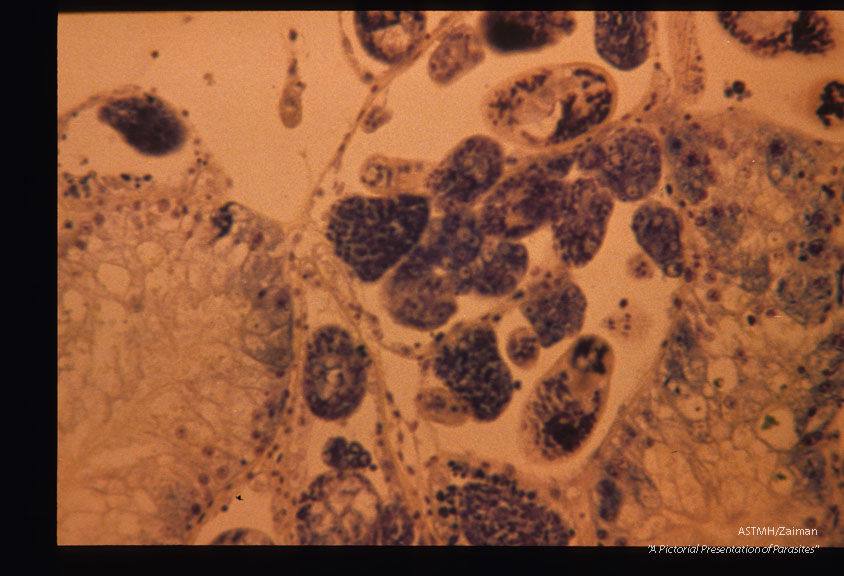 Sections through snail (Biomphalaria glabrata) liver containing sporocysts 54 days after infection.