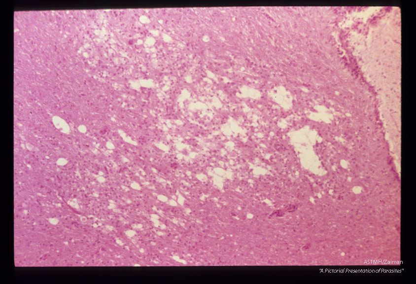 Rabbit cerebellum showing encephalitis, malacia and necrosis.