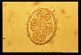 Development and hatching of larva.