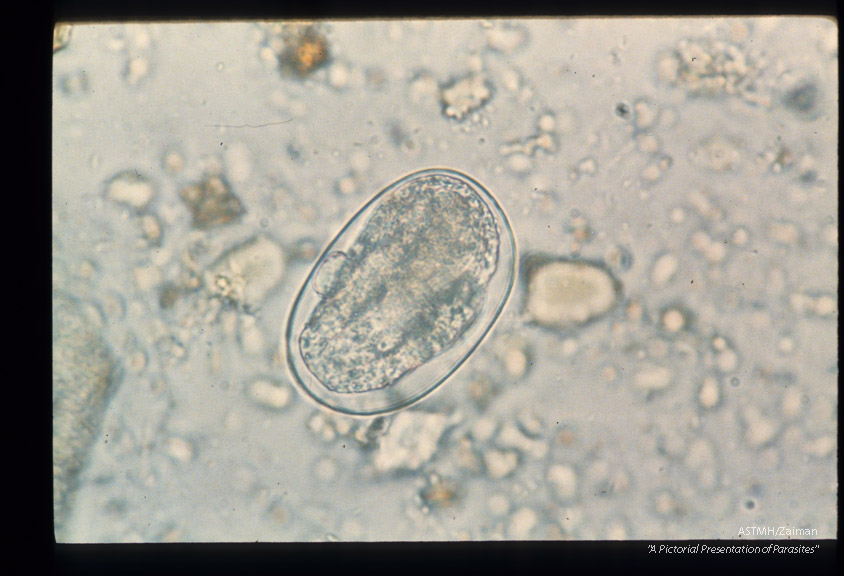 Sequence showing development of larva in egg.