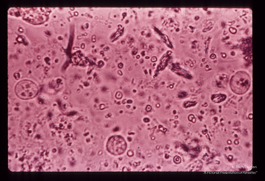 Cysts in feces. Iodine stained wet mount.