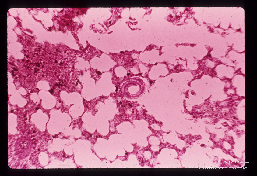 Larvae in alveolus of guinea pig.