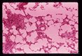 Larvae in alveolus of guinea pig.