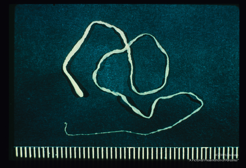 Plerocercoid from experimental rat infection. The anterior portion is thicker than the posterior. Relatively little detail can be seen in this slide. Compare with slides number 4 and 5.