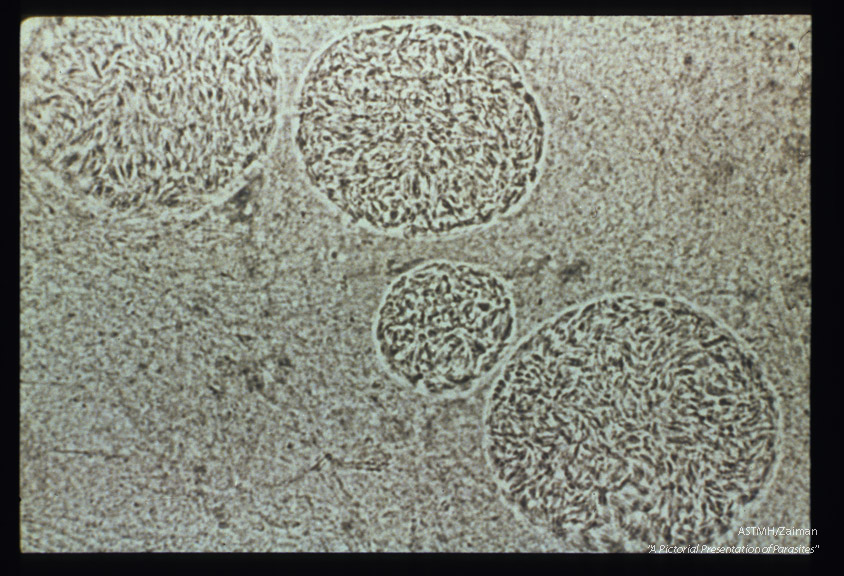 Cysts in unstained crush preparation of mouse brain.