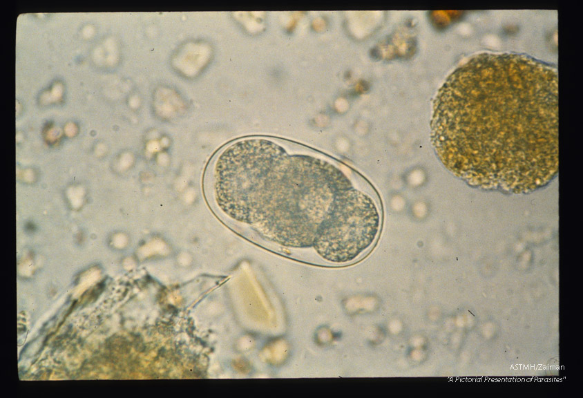 Sequence showing development of larva in egg.