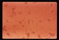 Lee-culture showing rbc, few cysts and amoeboid cells.