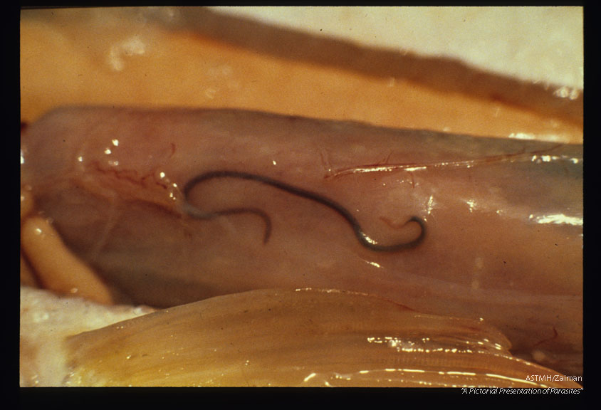 Nematodes in fish flesh and viscera.