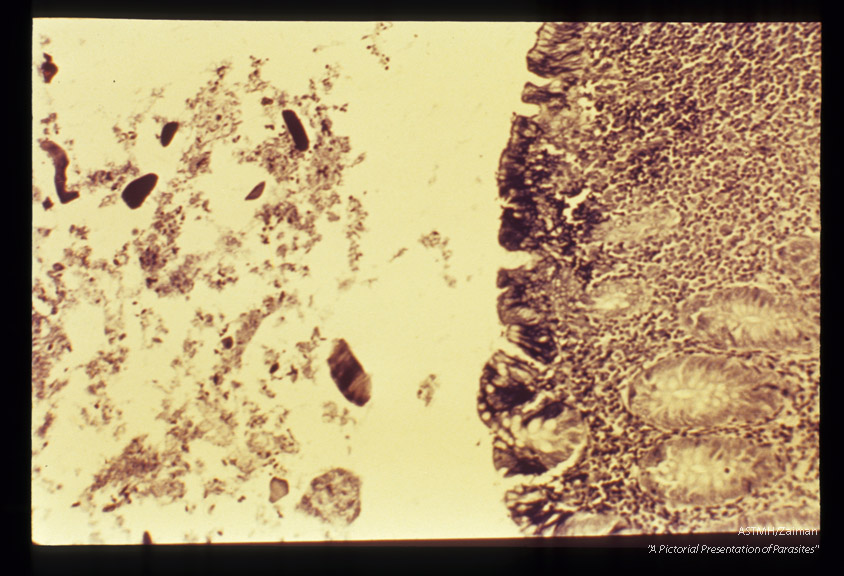 Human appendix, low and high powers. Iron hematoxylin stain.