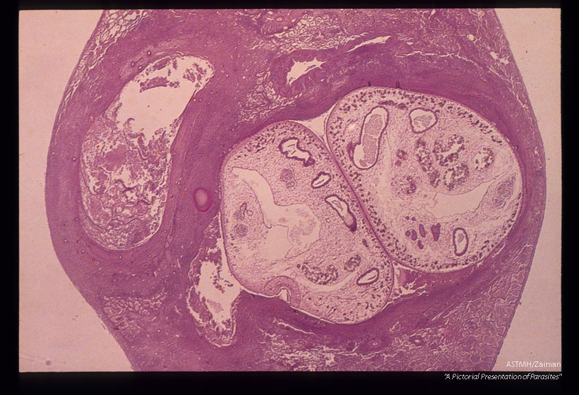 Adults in lung.