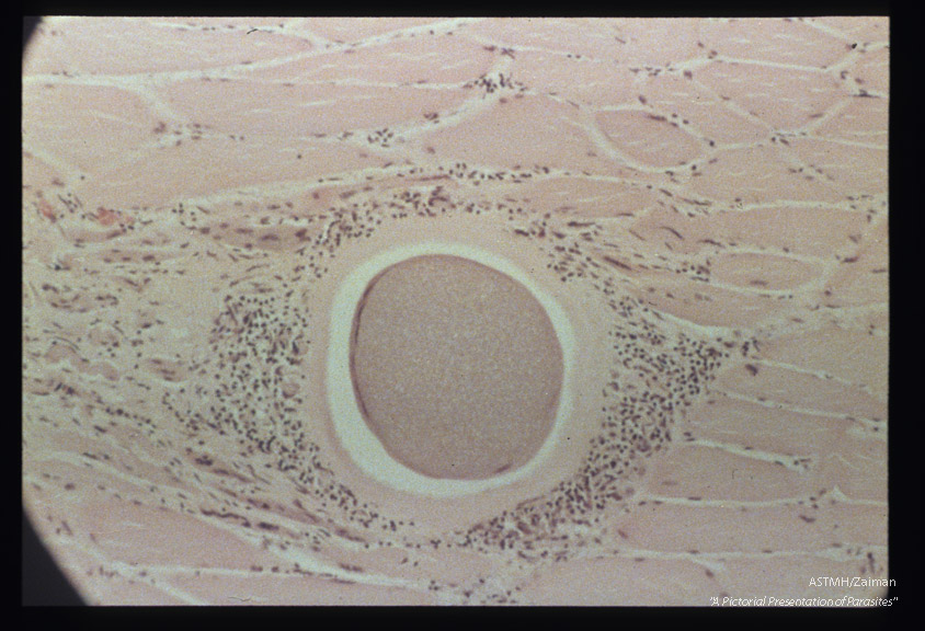 Cysts in striated muscle of reindeer.