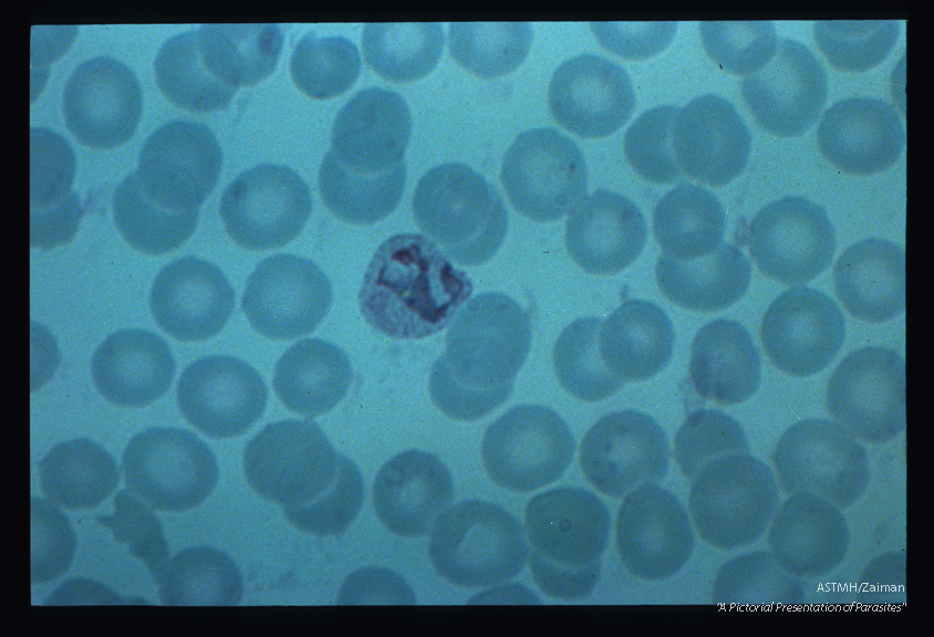 Trophozoites. The irregular dispersion of cytoplasm is evidence of the mobility of the parasite.