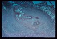 Adult worms ectopically located in the ante cubital apace of a Puerto Rican female.