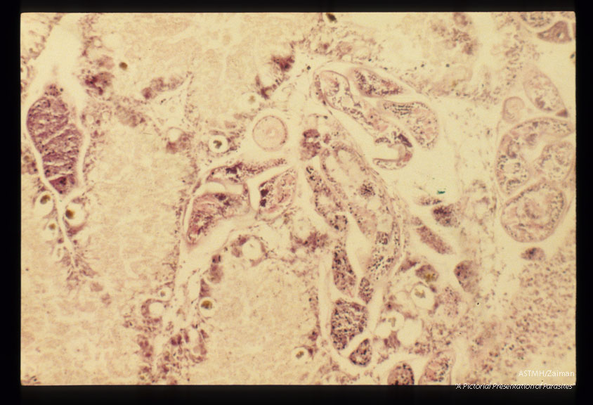 Cercaria in Brotia showing the stylet.