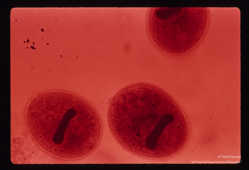 Trophozoites with well-stained macro- nuclei.