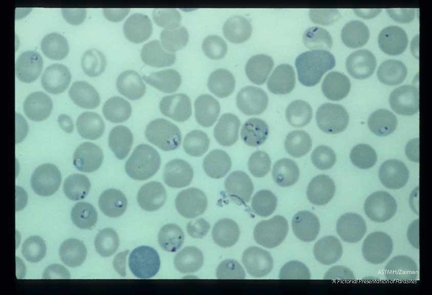 Multiple blood smears from experimental animals infected with material derived from human case.