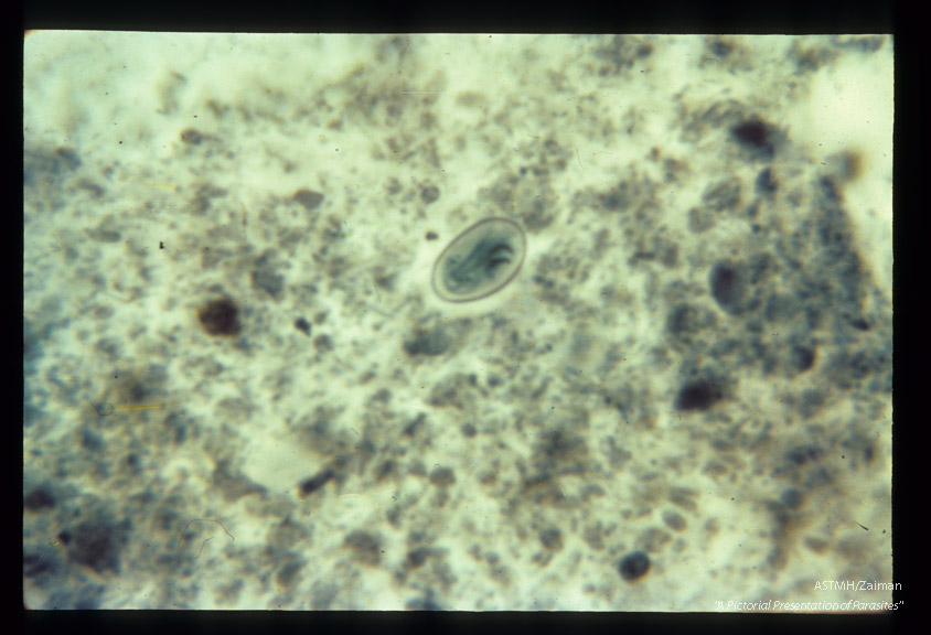 Cyst in stool. Chlorazol black stain.