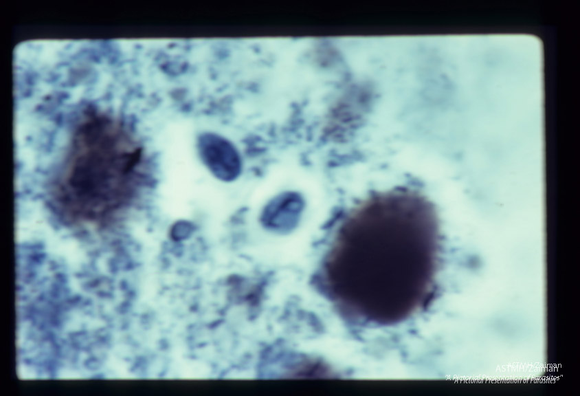 Cysts. Iron hematoxylin stain. Two cysts are present.