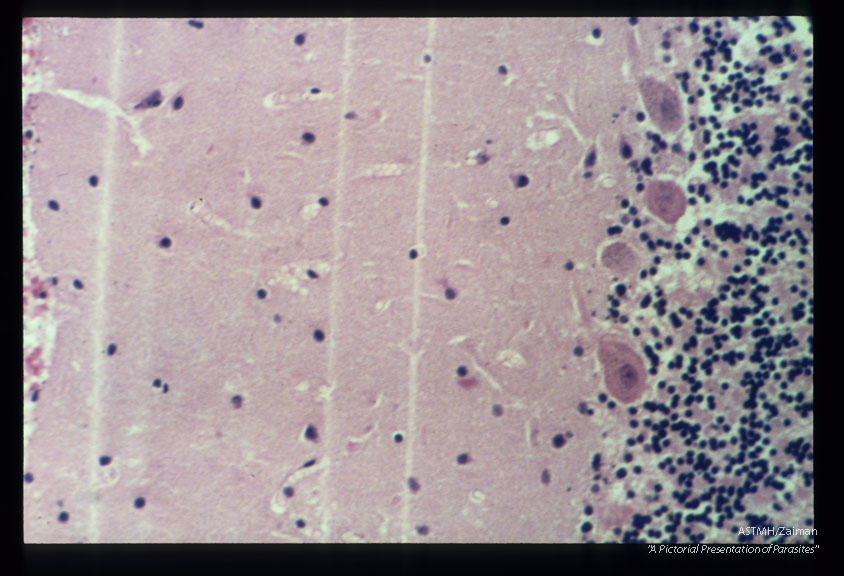 Ischemic Purkinje cells of the cerebellum.