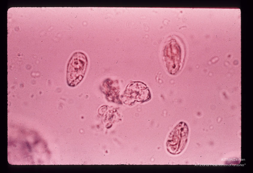 Cysts in feces. Iodine stained wet mount.