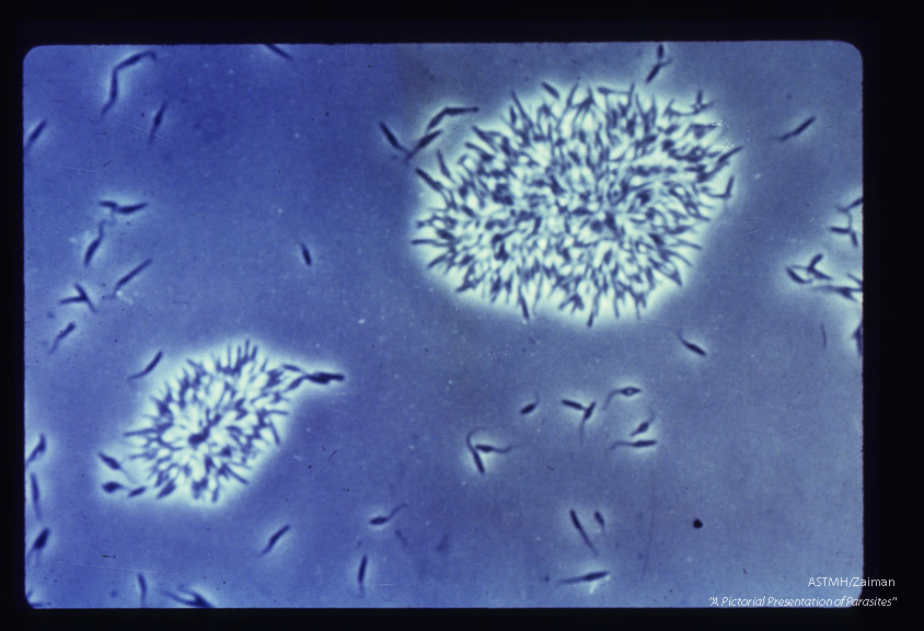 Low and high power views of leptomonads in culture, arranged in a rosette.