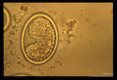 Development and hatching of larva.