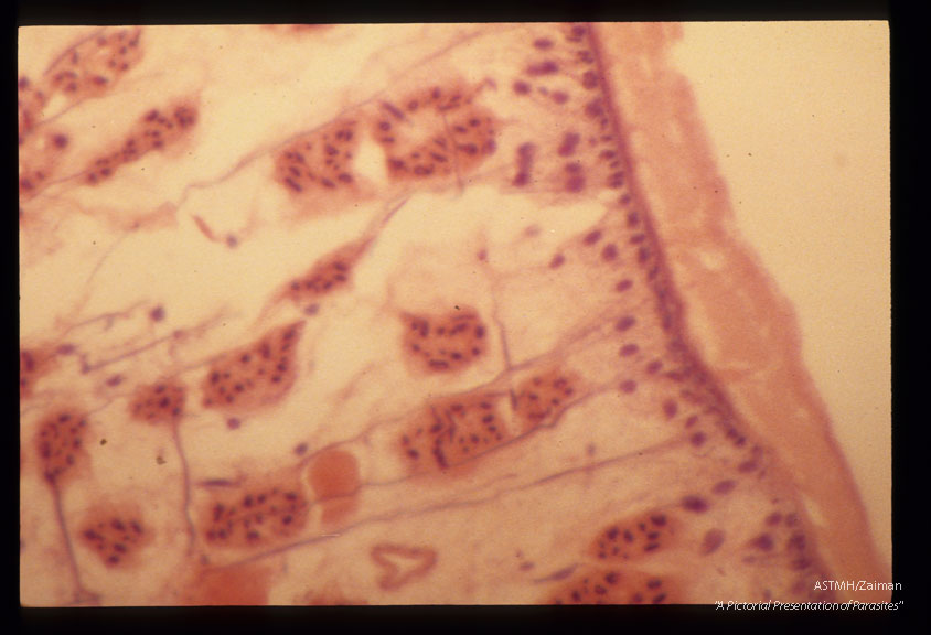 Multiple cross sections through the parasite at various magnifications are presented.