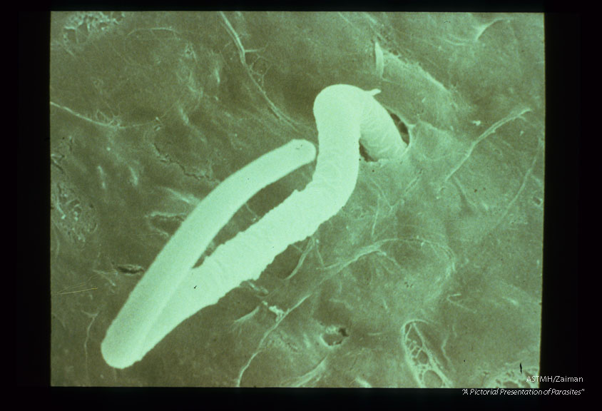 Scanning electron micrographs of microfilariae penetrating the midgut of Aedes aegypti. View is from the hemocoel side of the midgut and it should be noted that microfilariae usually retain their sheath during penetration.