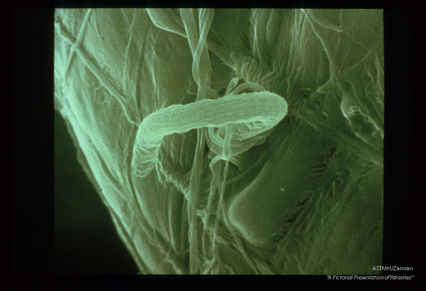 Scanning electron micrographs of microfilariae penetrating the midgut of Aedes aegypti. View is from the hemocoel side of the midgut and it should be noted that microfilariae usually retain their sheath during penetration.