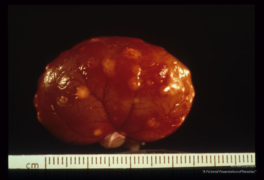 Large granulomas projecting from the renal cortex of a naturally infected cat.