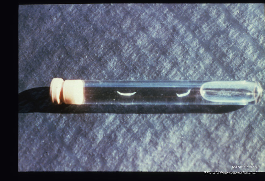 Two adults in a test tube.