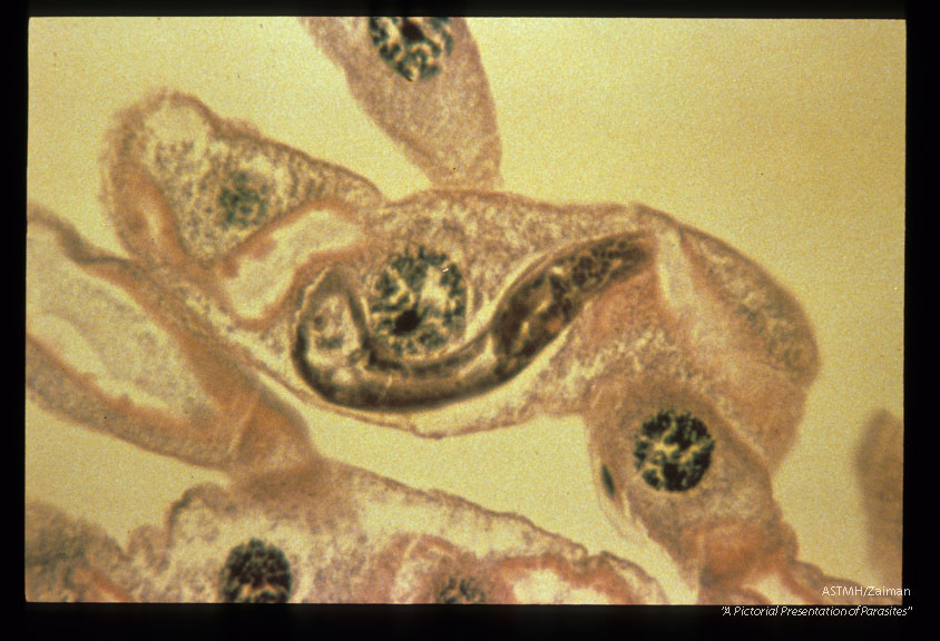 H & E-stained section of a first-stage larva within the Malpighian tubules of a mosquito.