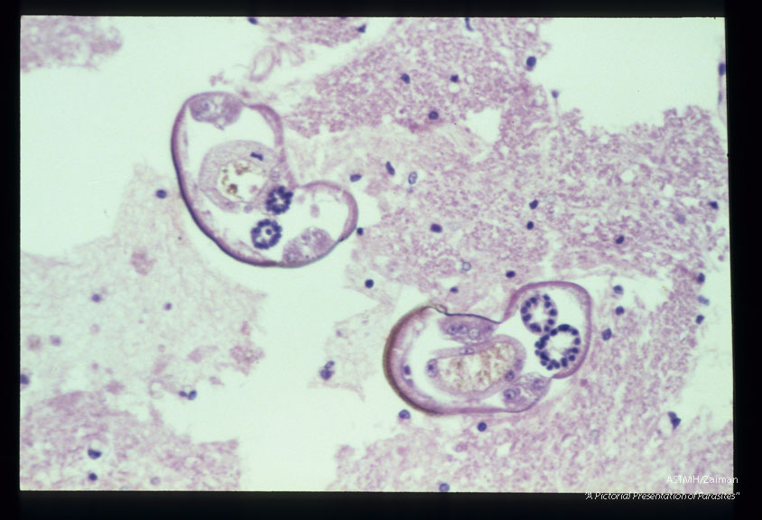 Longitudinal and cross-section of larvae in the spinal cord.