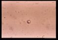 Peru strain forms emerging from infected Hela cells.