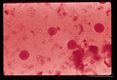 Iodine stained cysts in stool showing different numbers of nuclei.