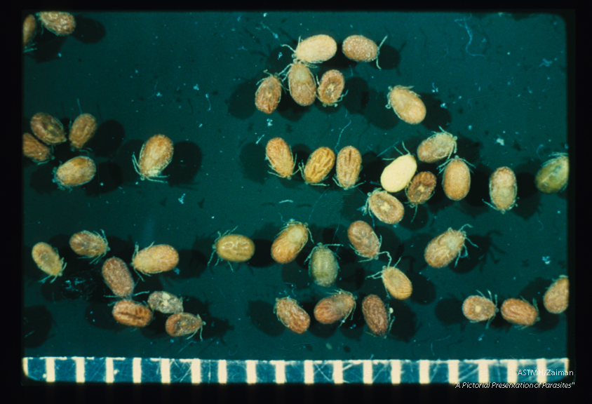 Seed ticks. Seed, or larval ticks have only three pairs of legs.