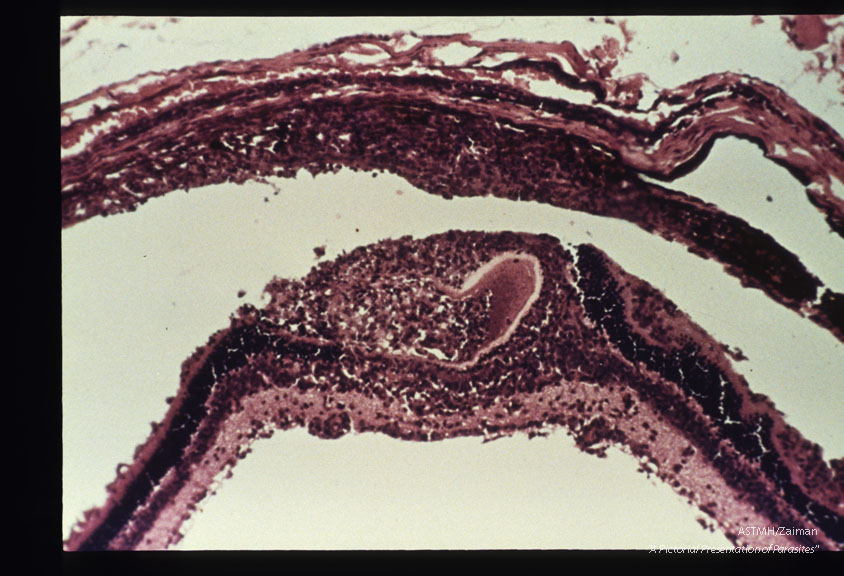 Cysts giving rise to retinochoroiditis in hamster. H&E stain.