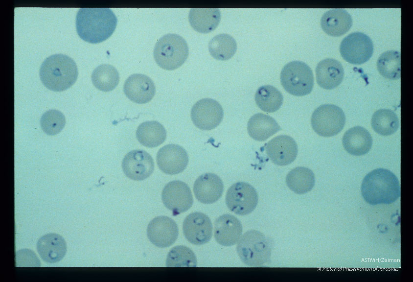 Multiple blood smears from experimental animals infected with material derived from human case.