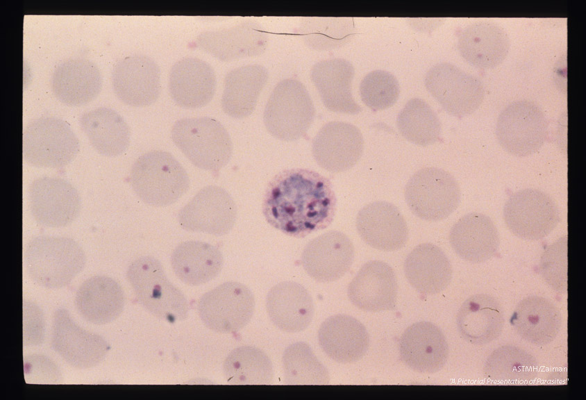 Schizogony from binucleate through multinucleate stages is demonstrated