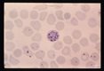 Schizogony from binucleate through multinucleate stages is demonstrated