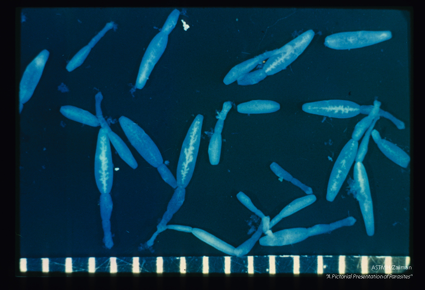 Adults. Formalin fixed, unstained. The anterior scolex and uterine structures (posterior segment) can be seen by those who are kindly disposed.