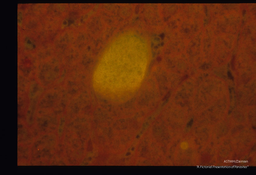 Demonstration of hypnozoiite and hepatic schizonts by immunof lucres cent antibodies and subsequent counterstaining by Giemaa-colophonium.