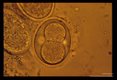 Development and hatching of larva.
