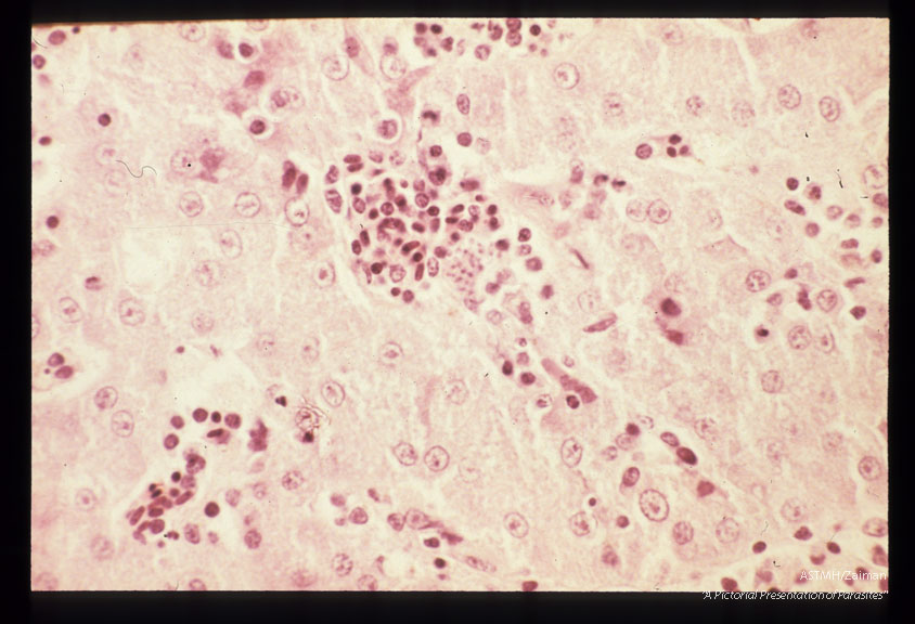 Schizont in budgerigar liver section stained with H & E. 4 weeks PI.